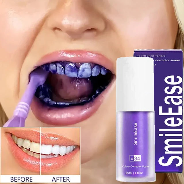 Hismile v34 Color Corrector Serum - Instant Teeth Whitening