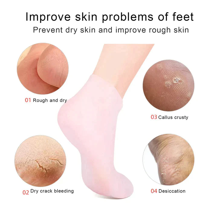 Free Home Delivery - Silicone Gel Moisturizing Socks and Protector ( 1 Pair )