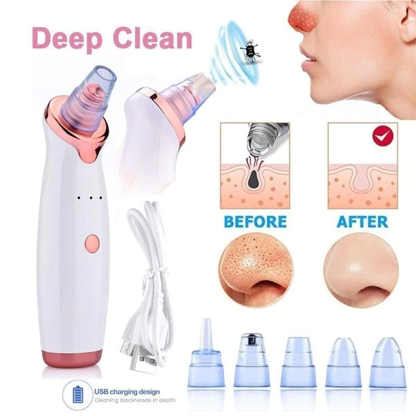 Electric USB Rechargeable Blackhead and Pore Remover