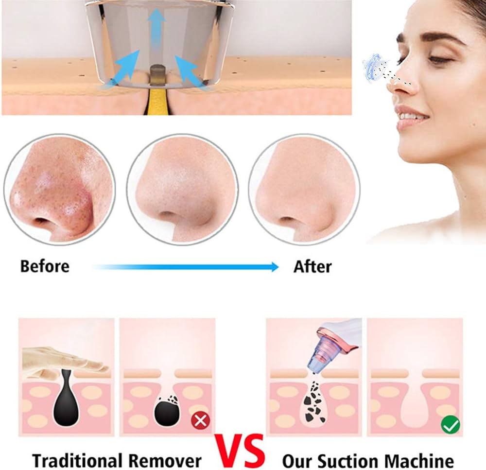 Electric USB Rechargeable Blackhead and Pore Remover