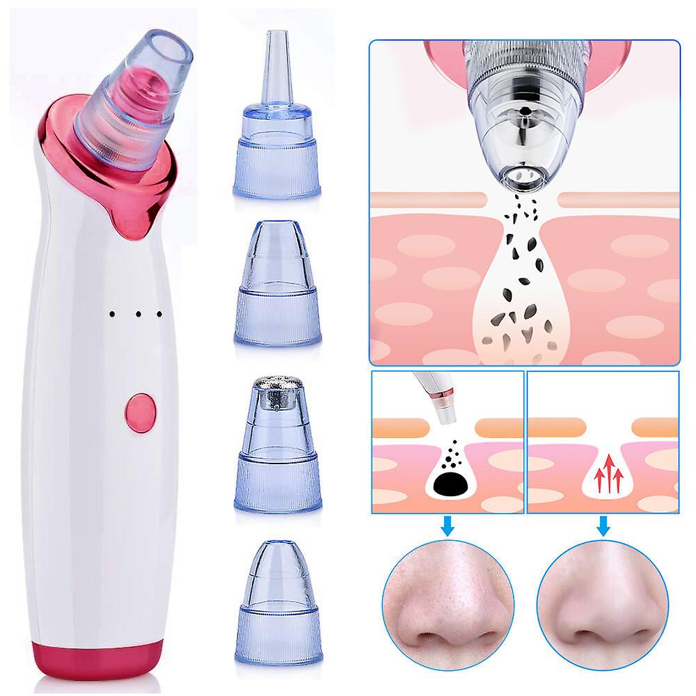 Electric USB Rechargeable Blackhead and Pore Remover